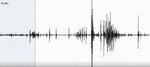 Bowel Sounds - SP001 - Left Lower Quadrant