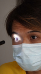 Neurology_examining pupillary light response_55