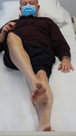 National Institute of Health Stroke Scale (NIHSS) item 7: limb ataxia (leg) by Clinical Neurological Sciences, Schulich School of Medicine and Dentistry