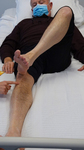 National Institute of Health Stroke Scale (NIHSS) item 7: limb ataxia (leg)
